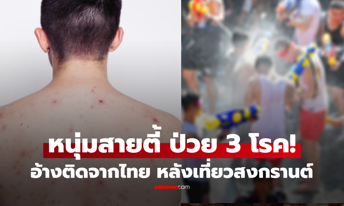 นทท.หนุ่ม ช็อก! ตรวจพบ 3 โรคแจ็คพอต อ้างติดจากไทย หลังเที่ยวสงกรานต์ เตือนสายตี้ระวัง