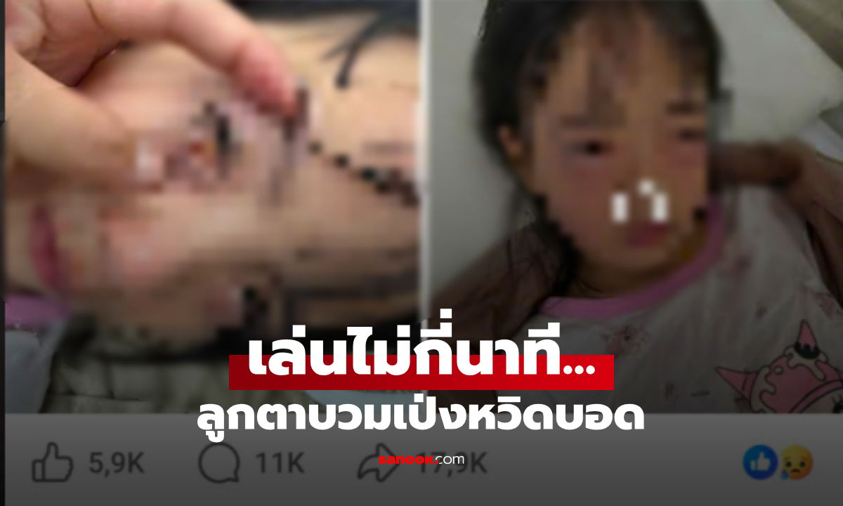 ภาพปวดตาร้องลั่น!! ลูก 5 ขวบหวิดบอด เล่น "เป่าฟองสบู่" แค่ไม่กี่นาที แม่โพสต์เตือนทุกบ้าน