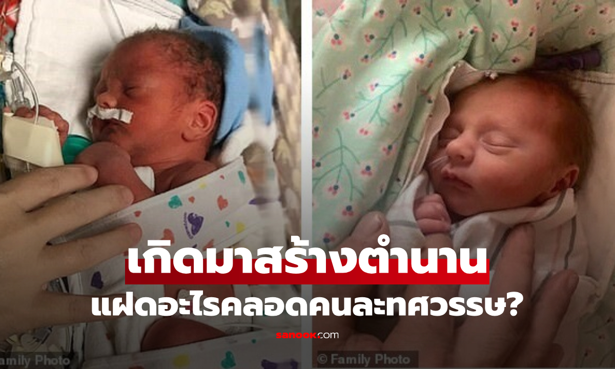 มหัศจรรย์ฝาแฝด คลอดจากแม่เดียวกัน แต่เกิดวัน-เดือน-ปี "ต่างกัน" แถมอยู่คนละทศวรรษ!