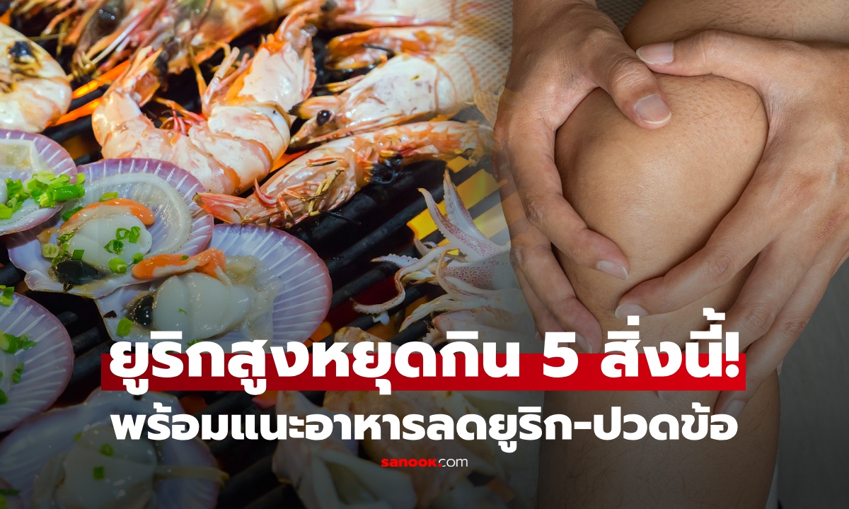 คนกรดยูริกสูงต้องหยุด! เปิด 5 อาหาร “ตัวร้าย”  ทำเกาต์กำเริบ พร้อมแนะตัวช่วยกินลดปวดข้อ