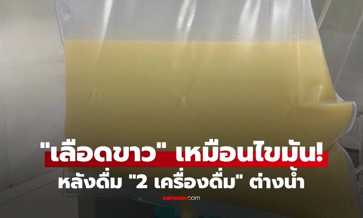 ช็อก! ชายวัย 29 เลือดเป็นสีขาวข้น เหมือน "ไขมัน" หลังดื่ม "2 เครื่องดื่มนี้" ต่างน้ำ 6 เดือน หวิดดับ