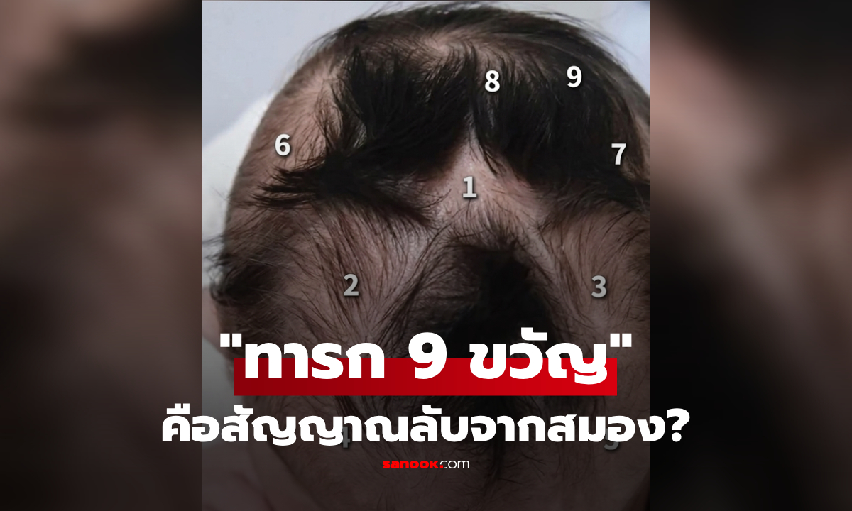 ฮือฮา! "ทารก 9 ขวัญ" กับปมเชื่อมโยงเรื่อง "สมอง" ที่วิทยาศาสตร์มีคำตอบแล้ว