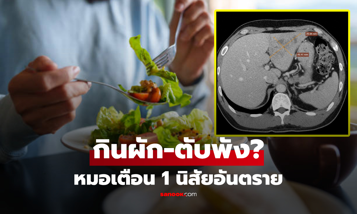 "เจ็บตับ" เพียงเพราะ 1 นิสัย "กินผัก" โดนไชตับจนเป็นอุโมงค์ หนุ่มใหญ่จบที่โรงพยาบาล!!