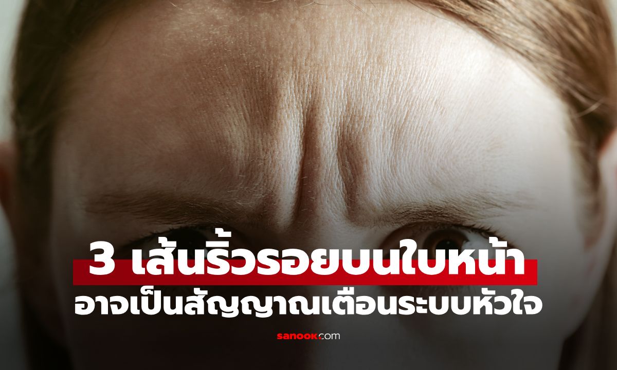 แพทย์แผนจีน เผย "3 เส้นริ้วรอย" บนใบหน้า อาจเป็นสัญญาณเตือนสุขภาพหัวใจ