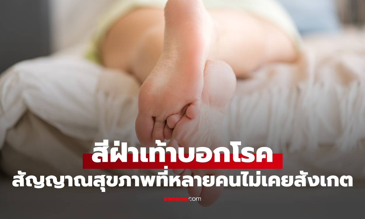 ฝ่าเท้าบอกโรค เช็กดู 3 สีที่ต้องระวัง สัญญาณเตือนสุขภาพที่หลายคนไม่เคยสังเกต