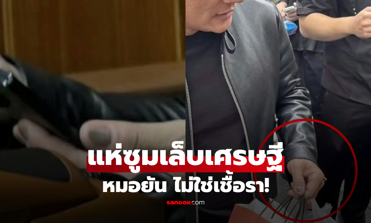ชาวเน็ตซูมเล็บ "เศรษฐีดัง" แซะรวยแสนล้านแต่สกปรก หมอผิวหนังรีบเบรก-เฉลยความจริง!!!