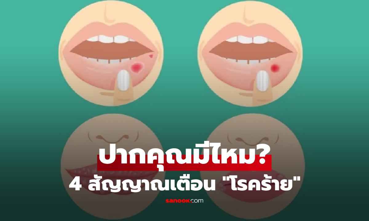 แพทย์เตือน 4 สัญญาณโรคร้าย ที่แสดงผ่าน "ริมฝีปาก" ไม่ใช่แค่แตก-ลอก-แผลหายช้า