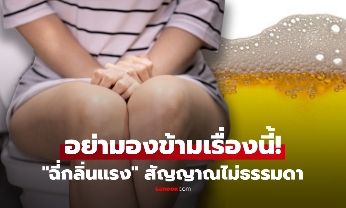 หลายคนมองข้าม! “ปัสสาวะกลิ่นแรง” อาจไม่ใช่แค่ดื่มน้ำน้อย หมอเตือนเสี่ยงโรคนี้โดยไม่รู้ตัว
