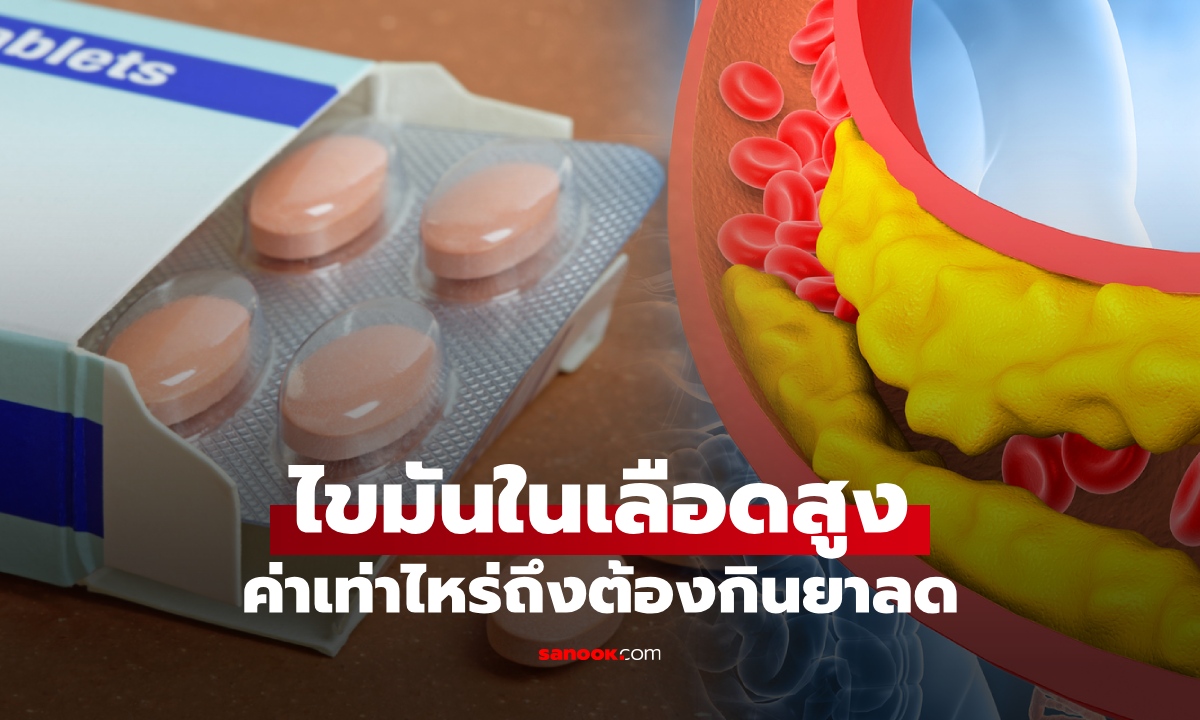ไขมันในเลือดสูงเท่าไหร่ต้องกินยา? ซื้อยากินเองได้ไหม ความเข้าใจผิดที่เสี่ยงอันตราย