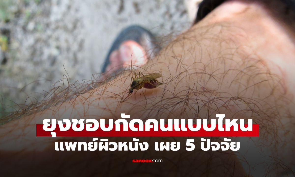 เกาจนขาลาย! แพทย์ผิวหนัง เผย 5 ปัจจัย ทำไมบางคนตกเป็น "เป้าสายตา" ของยุง