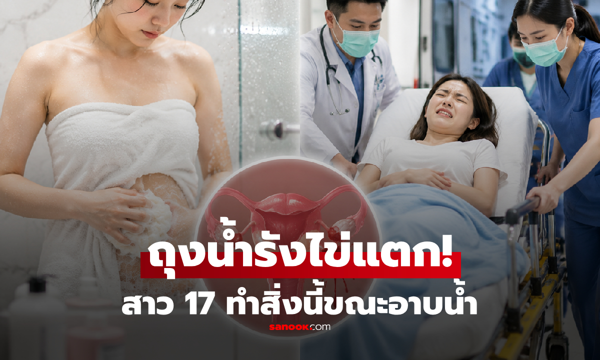 สาว 17 หวิดดับ "ถุงน้ำรังไข่แตก" เลือดทะลักเต็มช่องท้อง หมอชี้เพราะ 1 สิ่งที่ตอนอาบน้ำ!