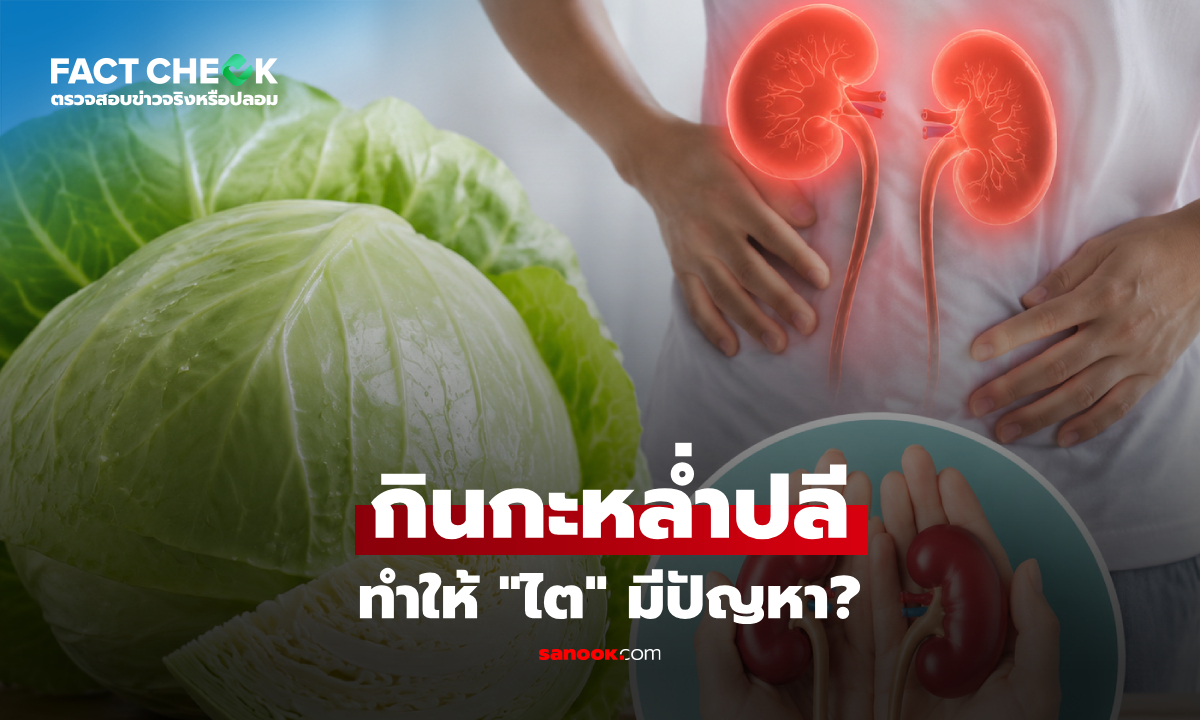 "กะหล่ำปลี" ทำให้เกิดปัญหาเกี่ยวกับไต จริงหรือไม่? แพทย์เฉลยคำตอบชัด : เช็กข่าวชัวร์