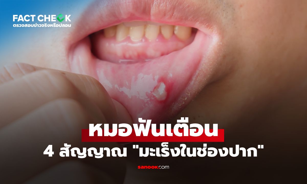 หมอฟันเตือน 4 สัญญาณเตือน "มะเร็งในช่องปาก" จริงหรือไม่? : เช็กข่าวชัวร์