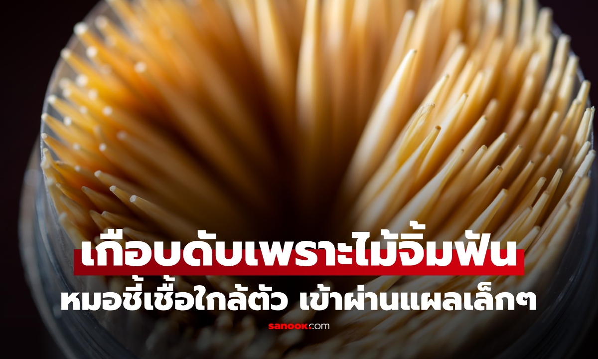 หมอเตือนคนชอบใช้ "ไม้จิ้มฟัน" อาจเสี่ยงถึงชีวิต แชร์เคสชาย ป่วยหนักเกือบดับ!