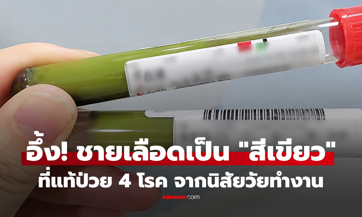 เตือนใจวัยทำงาน! ชายวัย 36 เลือดกลายเป็น "สีเขียว" ก่อนพบป่วยพร้อมกัน 4 โรค จากพฤติกรรมประจำวัน