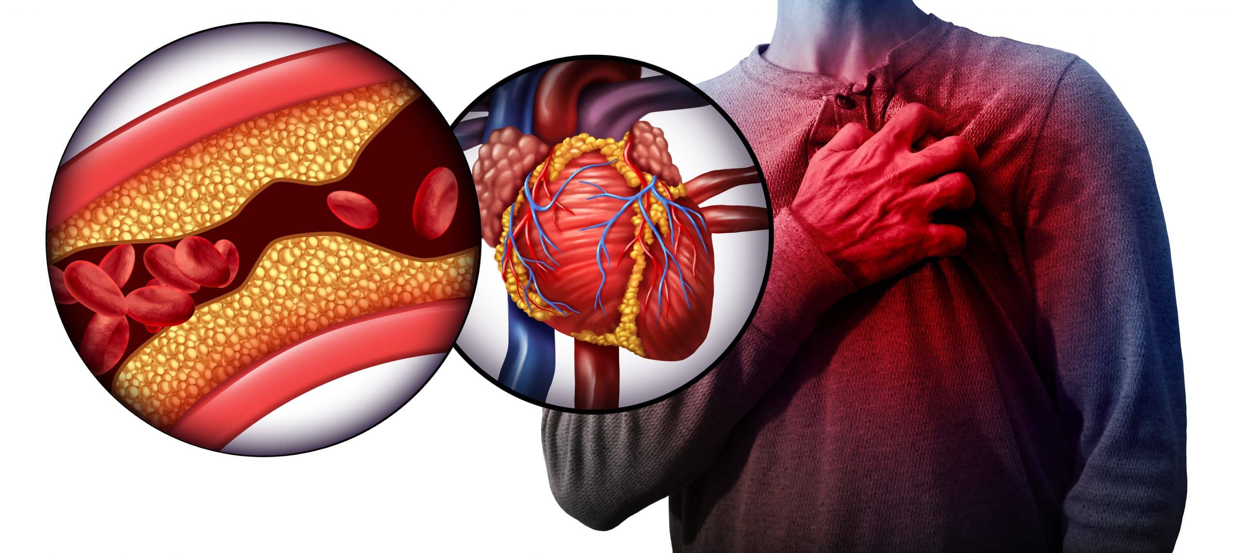hypertension-scaled-1