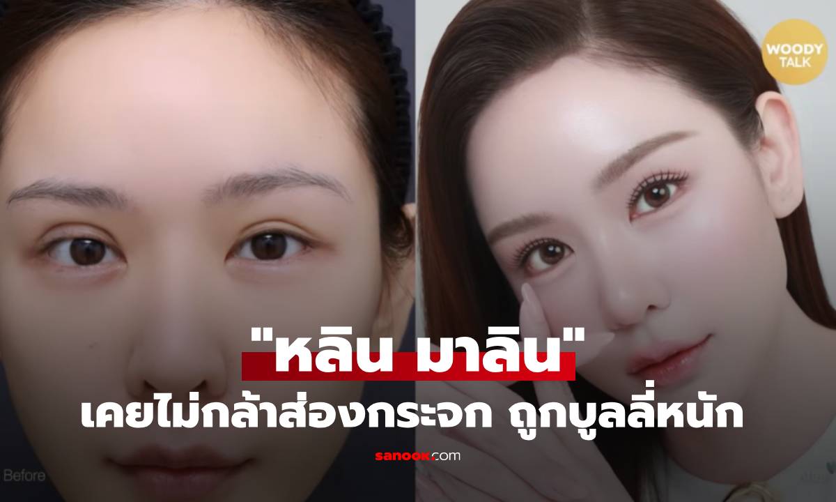 "หลิน มาลิน" เคยไม่กล้าส่องกระจก ถูกบูลลี่หนัก กลายเป็นปมในใจนานกว่า 2 ปี