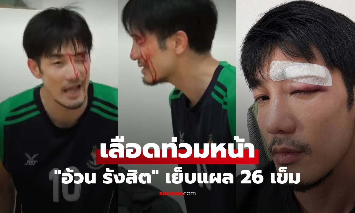 "อ้วน รังสิต" เลือดท่วมหน้า! เย็บแผล 26 เข็ม เผยสาเหตุทำแฟนๆ ใจหาย