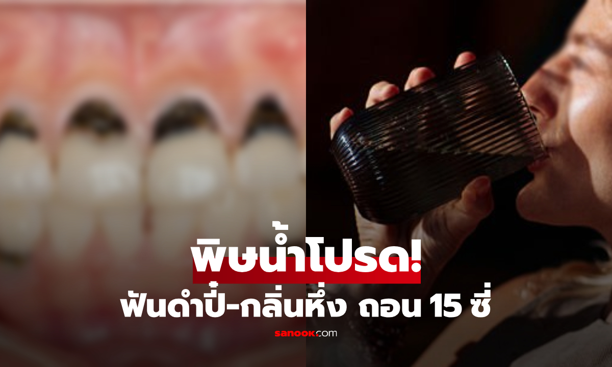 หญิงอายุน้อยแต่ "ฟันดำปี๋" กลิ่นเหม็นหึ่ง หมออุดรวด 15 ซี่ เฉลยสาเหตุเครื่องดื่มนี้!!
