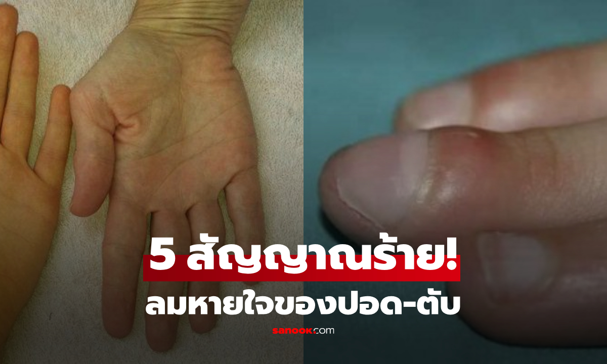 5 สัญญาณบน "มือและเล็บ" ลมหายใจของปอด-ตับ ที่กำลังร้องเตือนโรคร้าย เช็กก่อนสาย!