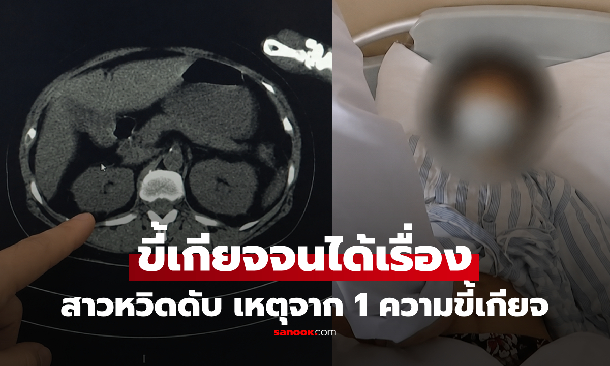 สาววัย 20 ติดเชื้อในกระแสเลือด หวิดดับ แพทย์ชี้ต้นเหตุจาก "ความขี้เกียจ" เล็กๆ ที่หลายคนทำทุกวัน
