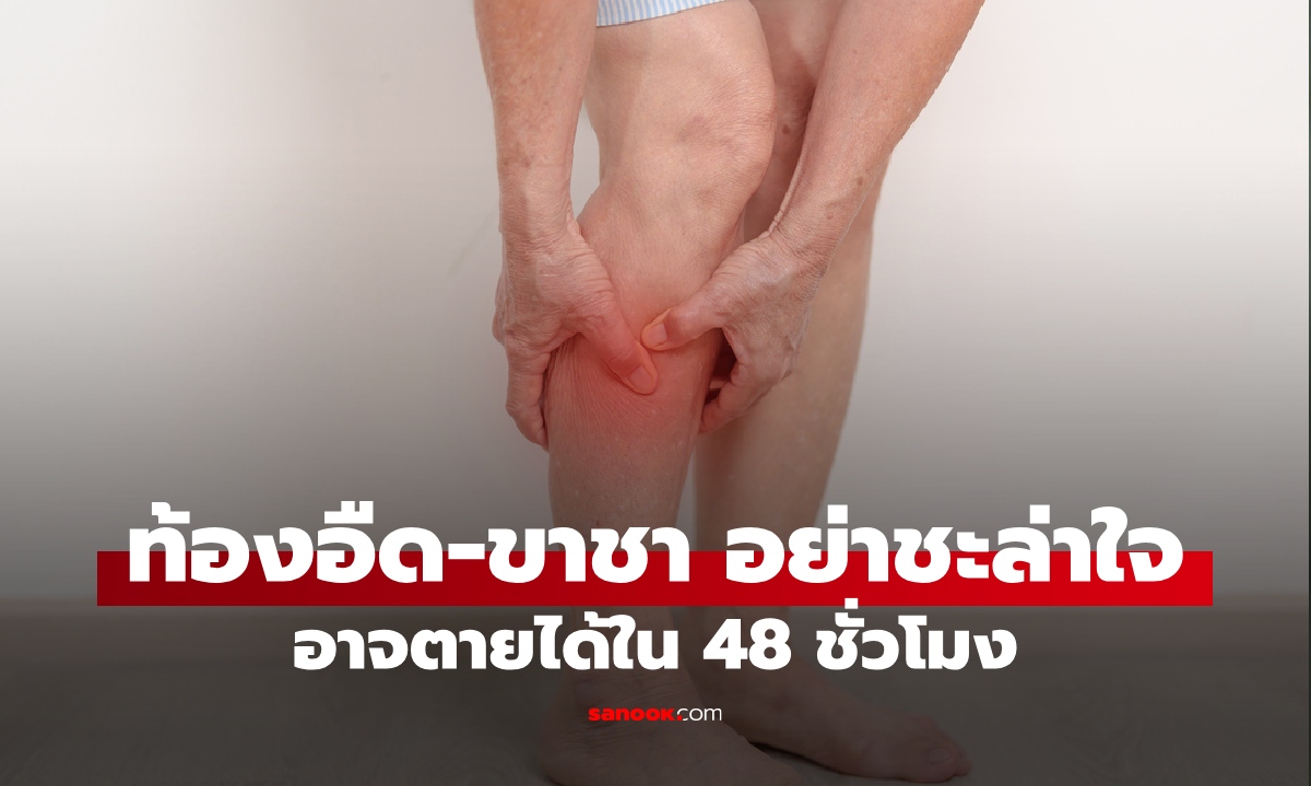 ท้องอืด-ขาชา อย่าชะล่าใจ! สัญญาณเตือนโรคอันตราย อาจตายได้ภายใน 48 ชั่วโมง