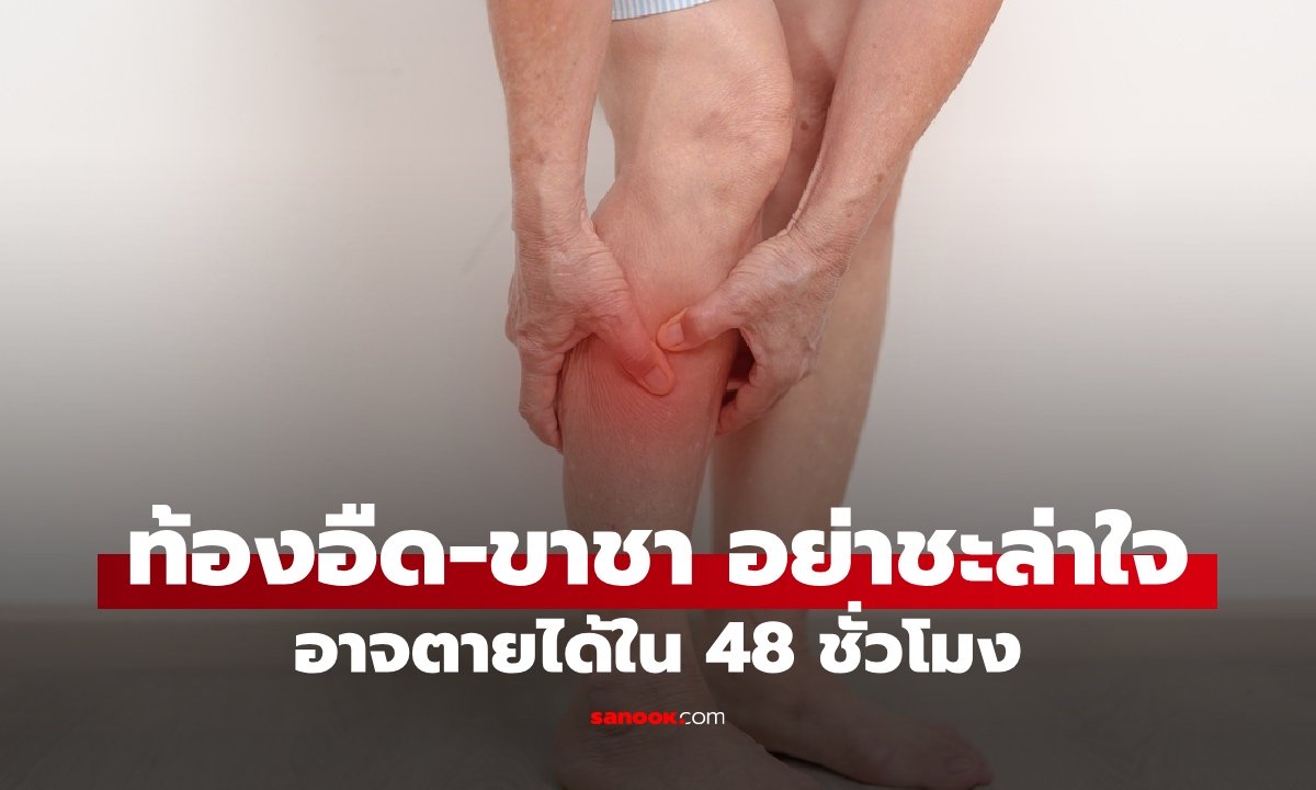 ท้องอืด-ขาชา อย่าชะล่าใจ! สัญญาณเตือนโรคอันตราย อาจตายได้ภายใน 48 ชั่วโมง
