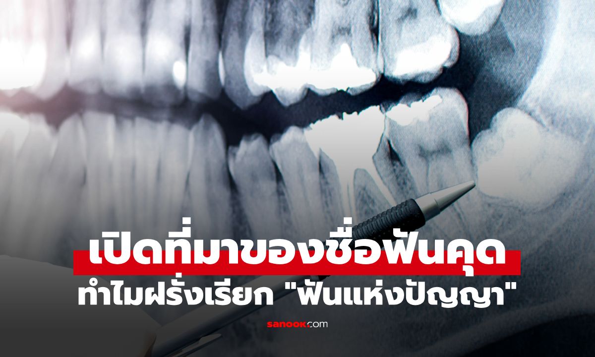 ฟันคุด ภาษาอังกฤษ ทำไมฝรั่งเรียก "ฟันแห่งปัญญา" ทั้งที่มีแต่ความเจ็บปวดทรมาน?