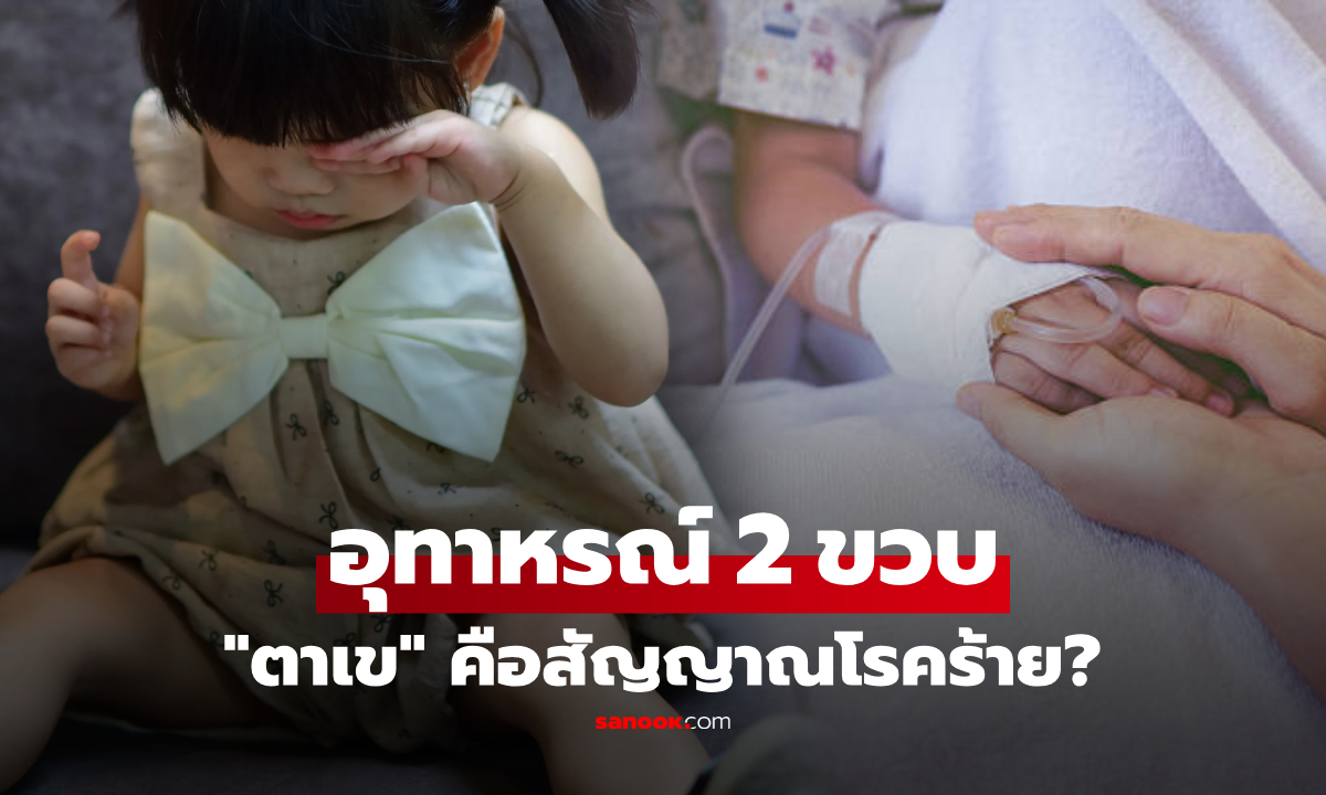 ตาเขคือสัญญาณโรคร้าย? เด็ก 2 ขวบร้องหาแม่ แป๊บเดียวต้องเจาะคอใส่เครื่อง ECMO