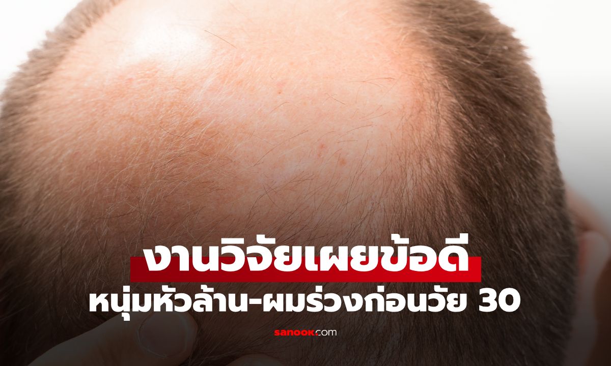 หนุ่มหัวล้านมีเฮ! วิจัยเผย "ผมร่วงก่อนวัย 30" ซ่อนข้อดี ช่วยลดเสี่ยงโรคร้าย 29%