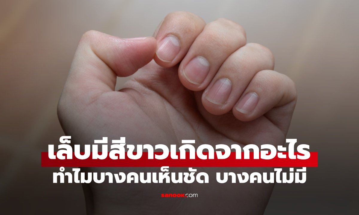 เล็บมีสีขาวเกิดจากอะไร? ทำไมบางคนเห็นชัด บางคนไม่มี แบบไหนอันตราย