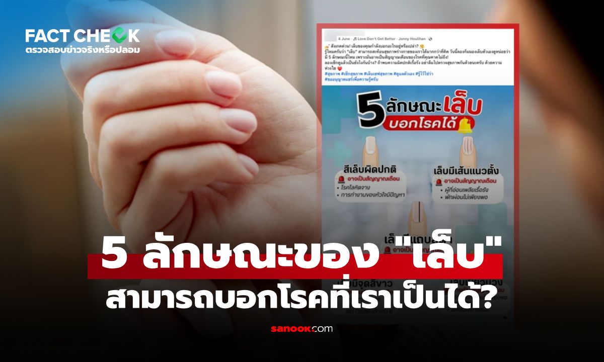 5 ลักษณะของ "เล็บ" สามารถบอกโรคที่เราเป็นได้ จริงหรือไม่? : เช็กข่าวชัวร์