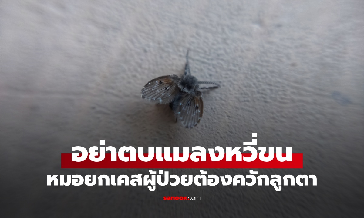 อย่าตบ "แมลงหวี่ขน" ซ่อนอันตรายที่คาดไม่ถึง หมอยกเคสเตือผู้ป่วยต้องควักลูกตา!