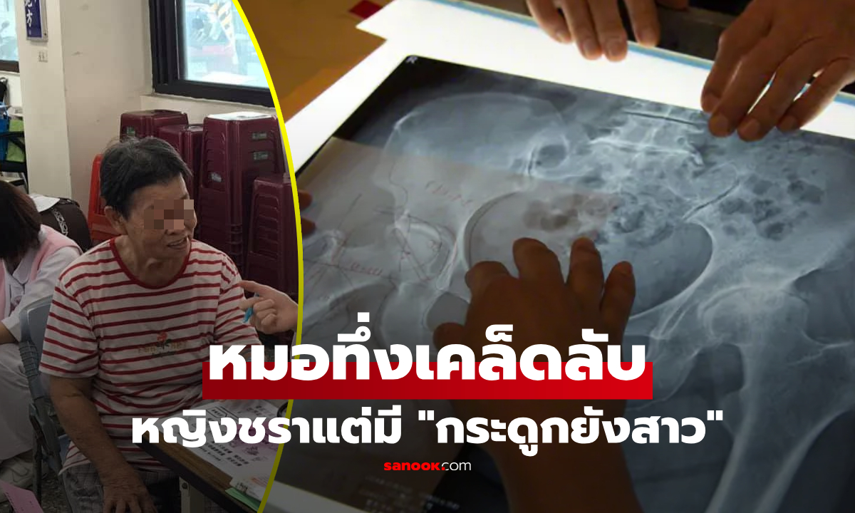 หมอทึ่ง! หญิงวัยชราแต่มี "กระดูกยังสาว" บอกต่อเคล็ดลับ 3 สิ่งง่ายๆ ที่ทำมานาน