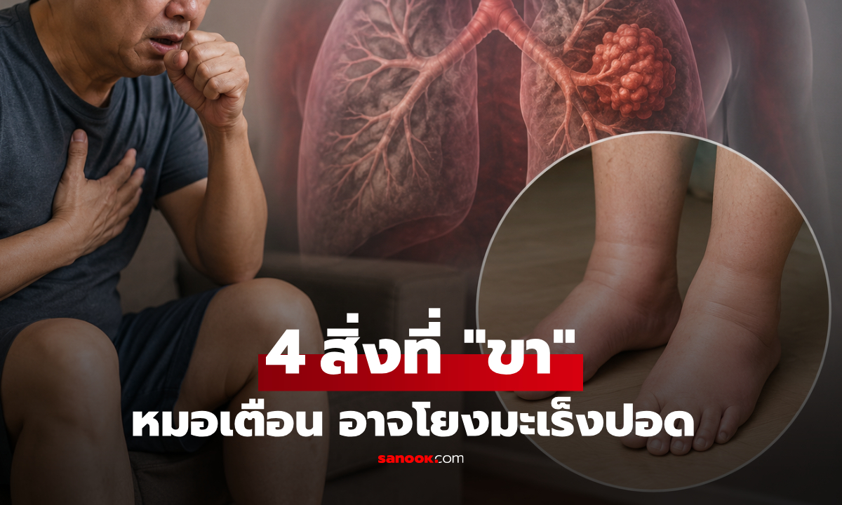 หมอเตือน 4 ความผิดปกติที่ "ขา" อาจโยงมะเร็งปอด แต่หลายคนมองข้ามคิดว่าอาการทั่วไป!