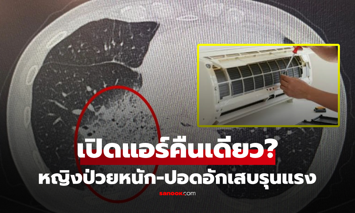 เพราะเปิดแอร์นอน? หมอเฉลยเคส หญิงไข้สูงไม่ลด พบปอดอักเสบจากเชื้อ Legionella