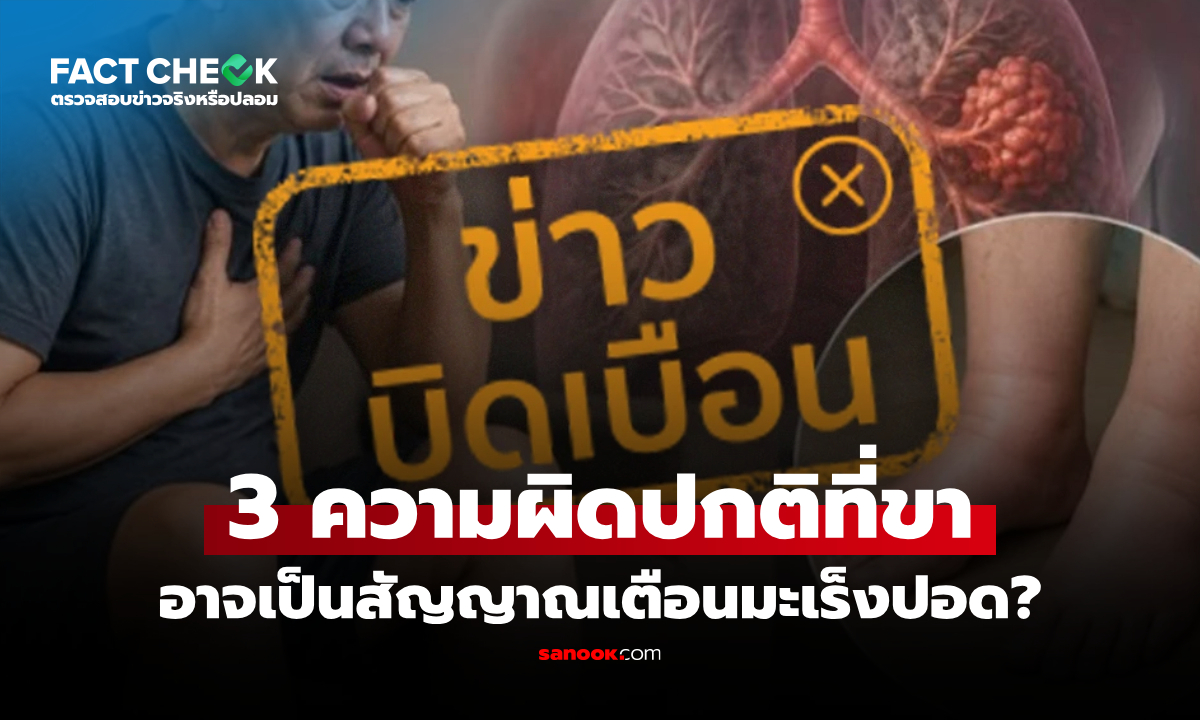 3 ความผิดปกติที่ขา อาจเป็นสัญญาณเตือนมะเร็งปอด จริงหรือไม่? : เช็กข่าวชัวร์