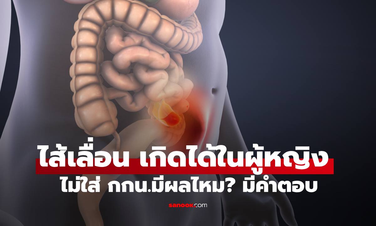 "ไส้เลื่อน" เกิดได้ในผู้หญิง ไม่ใส่่กางเกงในมีผลไหม? มีคำตอบพร้อมอาการเตือน