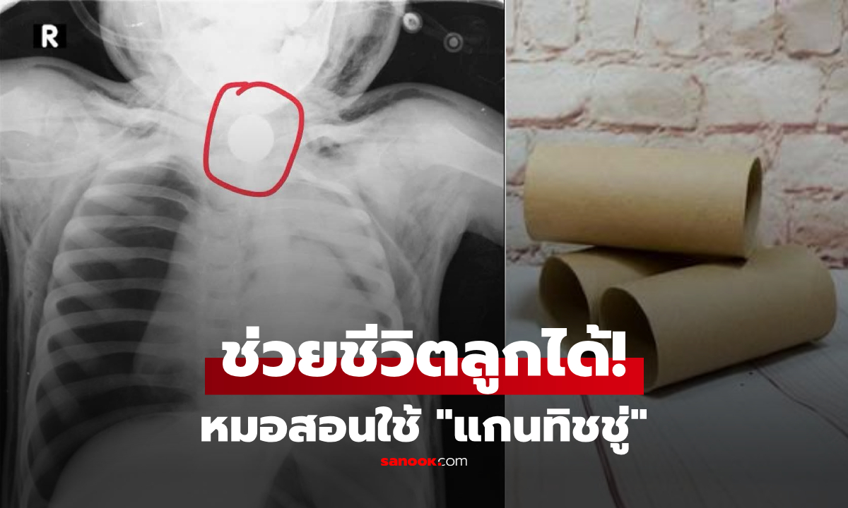 ใช้แค่ "แกนกระดาษทิชชู่" ป้องกันลูกสำลัก-ติดคอ! หมอเด็กเผยวิธีง่ายๆ ที่พ่อแม่ต้องรู้