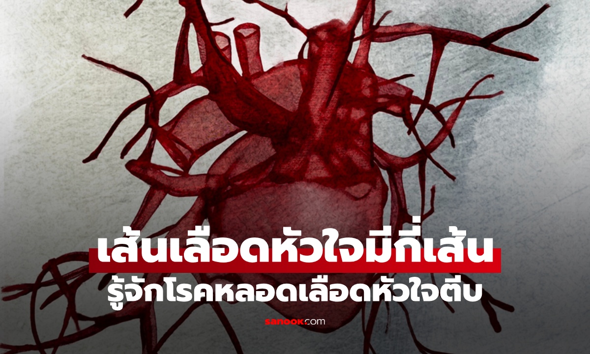 เส้นเลือดหัวใจมีกี่เส้น? รู้จัก โรคหลอดเลือดหัวใจตีบ ภัยเงียบที่ผู้ป่วยอาจไม่รู้ตัว