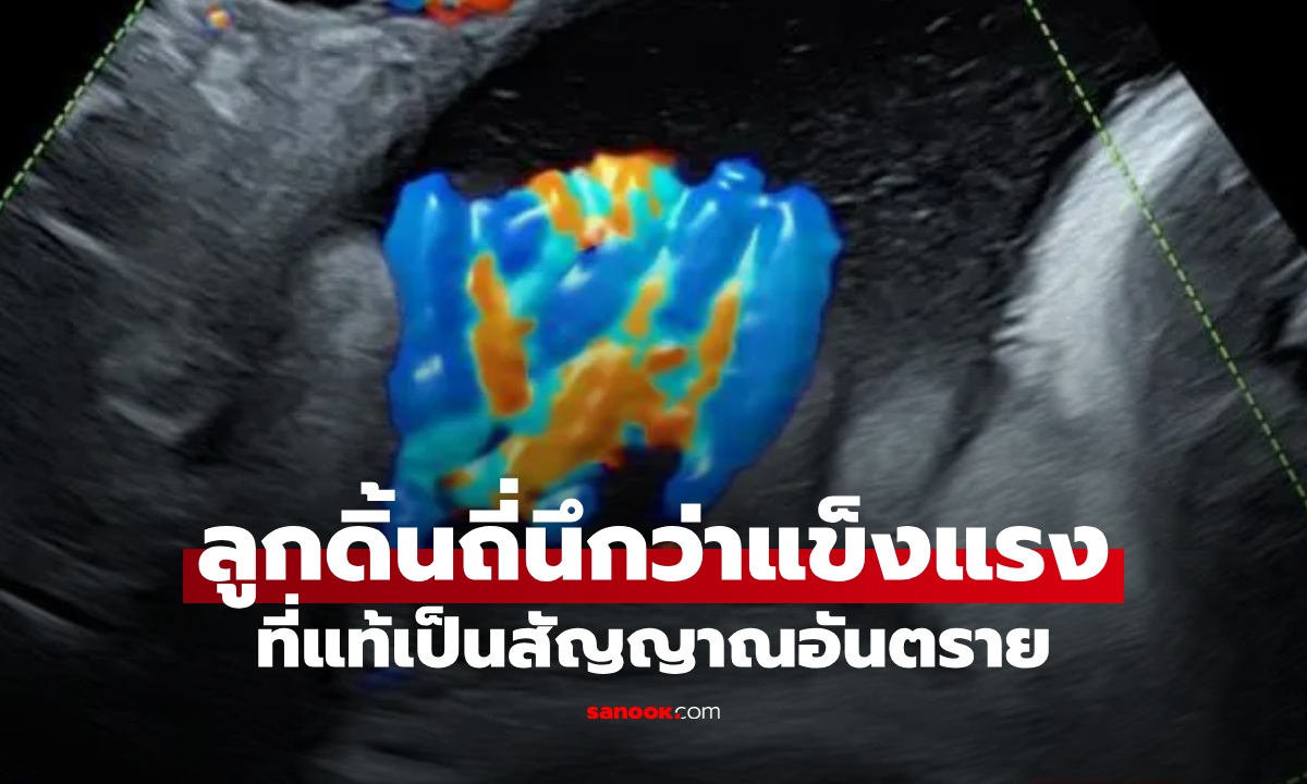 แม่ท้องใกล้คลอด ลูกดิ้นบ่อยนึกว่าแข็งแรง ที่แท้เป็นสัญญาณขอความช่วยเหลือ!