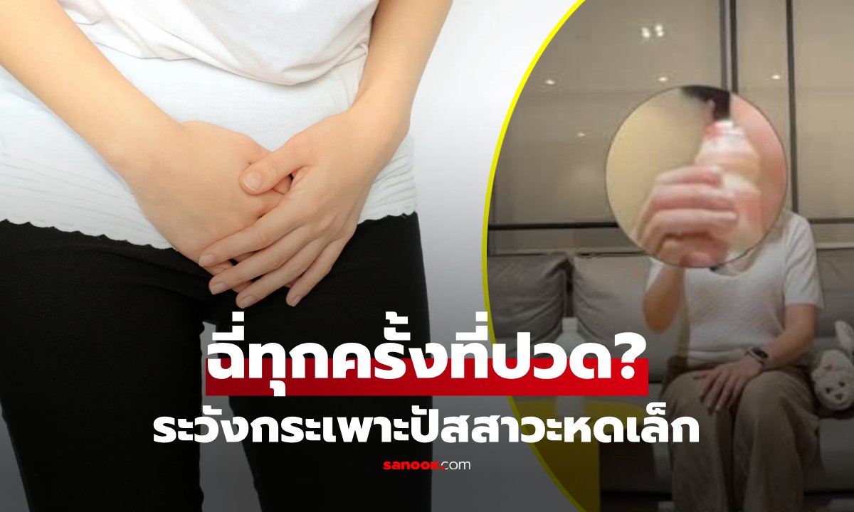 คุณฉี่ทุกครั้งที่ปวด? กระเพาะปัสสาวะหดเล็กเท่า "ขวดนมเปรี้ยว" แพทย์ชี้วิธีลดปวดฉี่บ่อย!