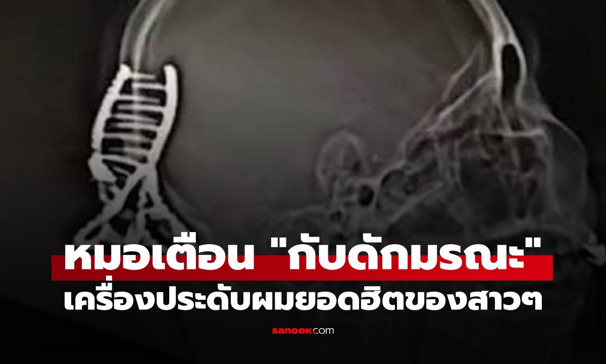 หมอฉุกเฉินเตือนเอง! ไอเทมติดผมยอดฮิตของสาวๆ เสี่ยงฝังในกะโหลกยามเกิดอุบัติเหตุ