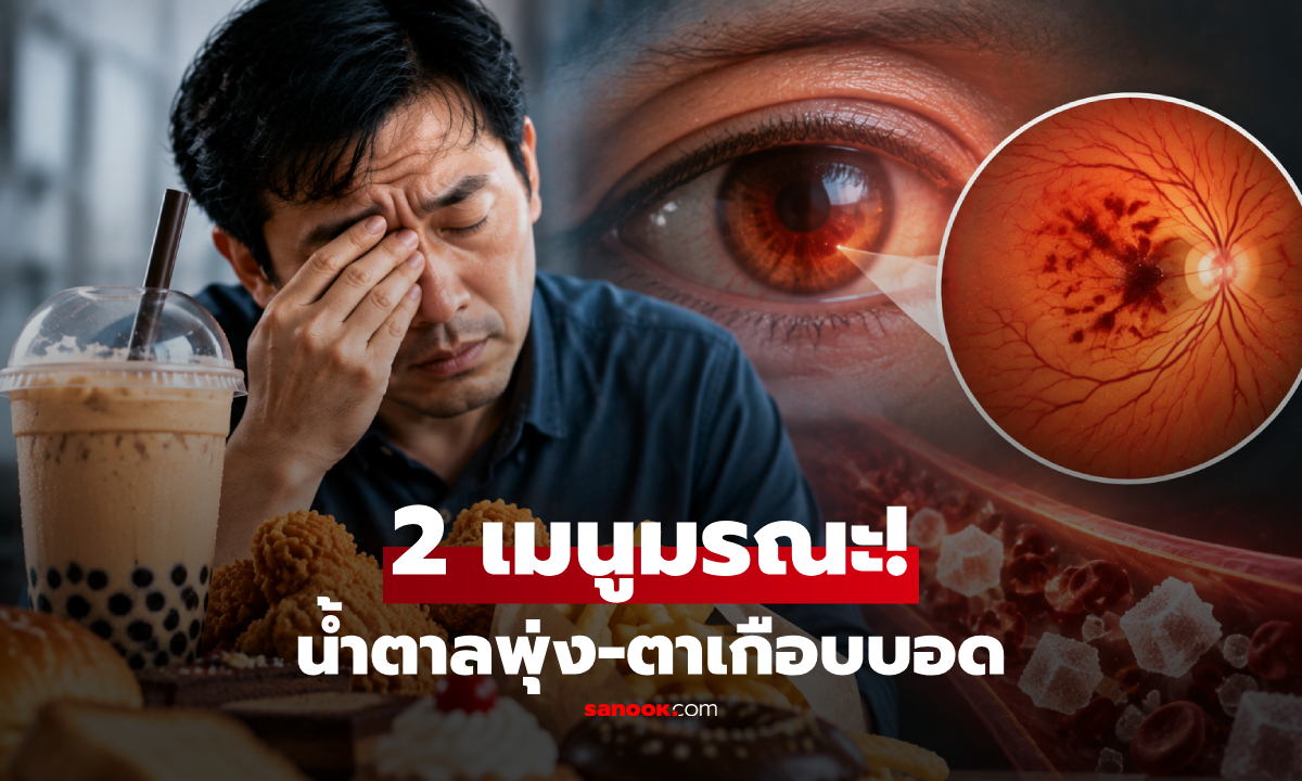 ชายเผย 2 เมนูมรณะ ทำน้ำตาลพุ่งกระฉูด 400 หลอดเลือดตาแตก "เกือบตาบอด"