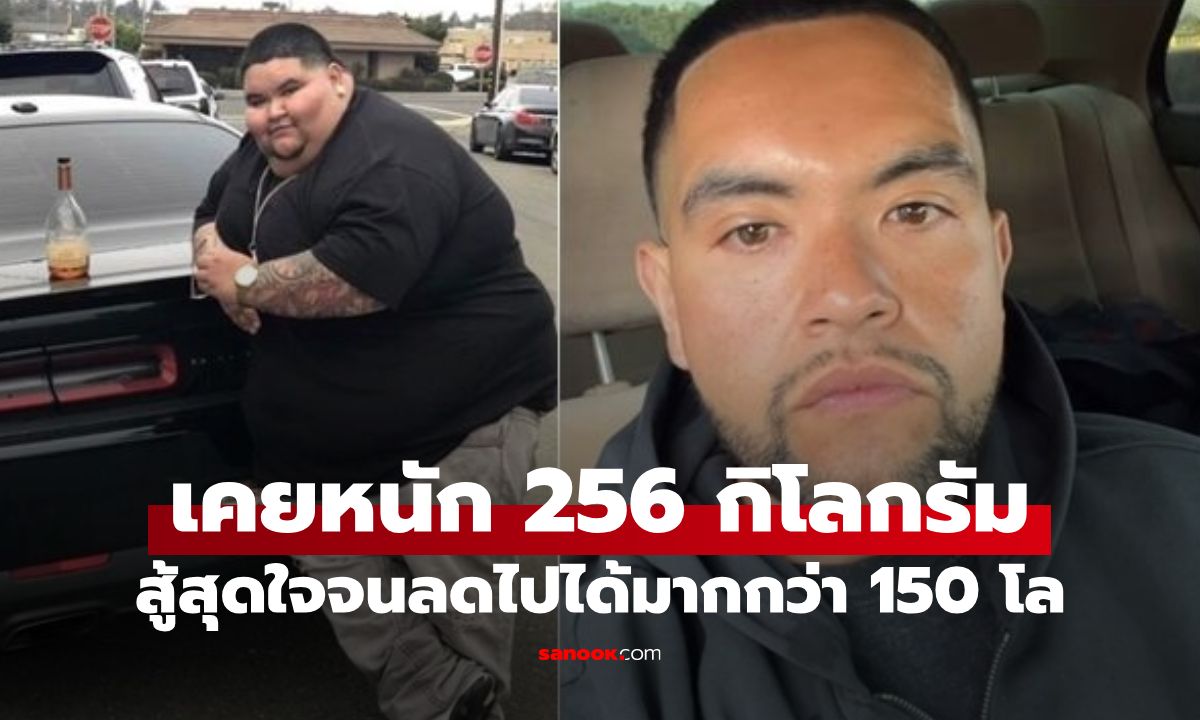 เกือบอ้วนตาย! ชายเคยหนัก 256 โล ไม่ใช้ยา-ปักปากกา สู้สุดใจลดได้กว่า 150 โล