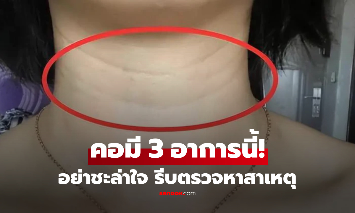 3 สัญญาณผิดปกติที่คอ หากพบแล้วอย่าชะล่าใจ อาจถึงเวลาต้องตรวจหาสาเหตุ