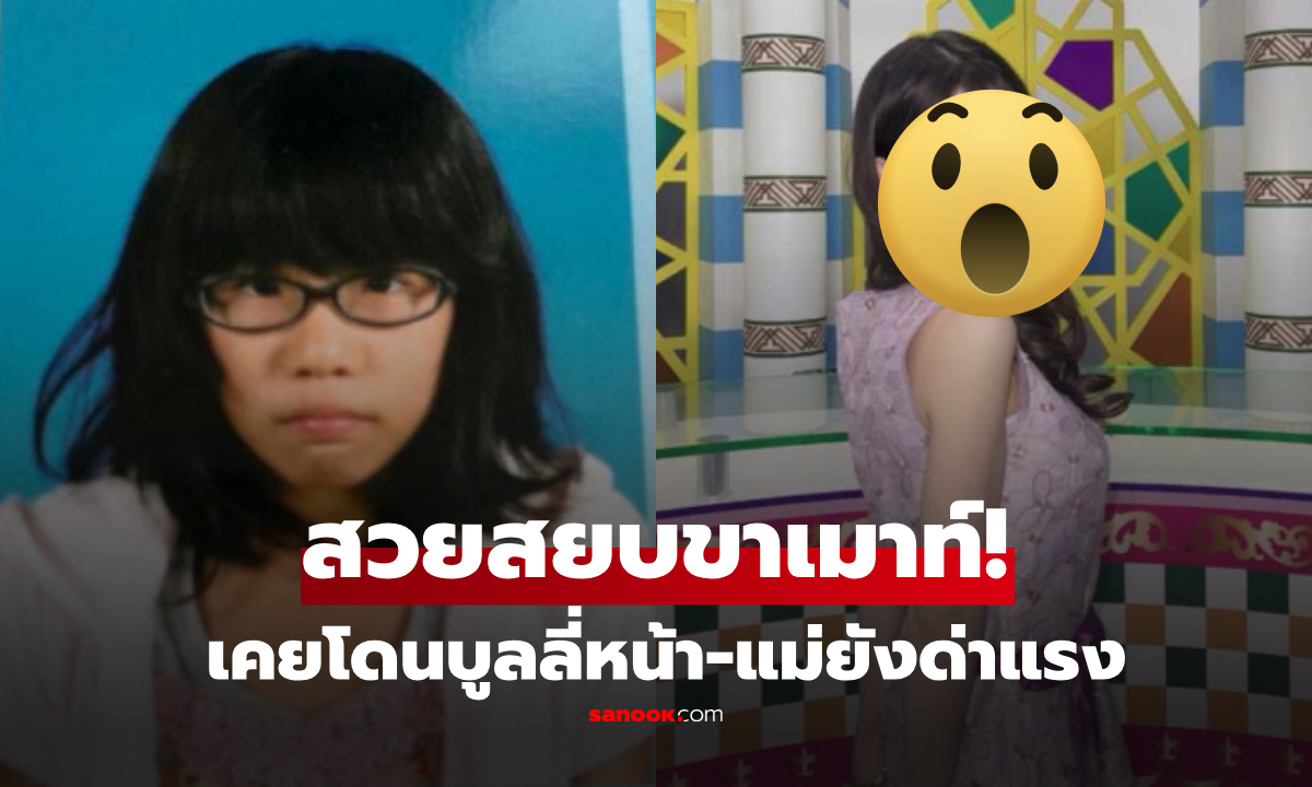 เด็กสาวถูกบูลลี่หน้า แม่ยังด่า "ไม่น่าคลอดออกมา" ล่าสุดเผยรูปหลังศัลยกรรม!
