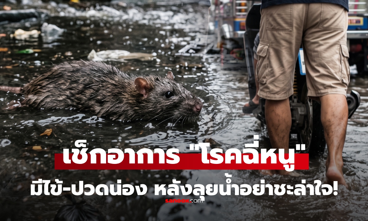 มีไข้ ปวดน่อง ร่วม 3 อาการนี้หลังลุยน้ำ อย่าชะล่าใจ สัญญาณ "โรคฉี่หนู" ที่ไม่ควรรอดูอาการ
