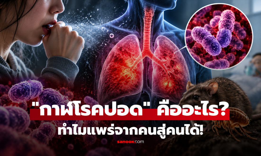 “กาฬโรคปอด” คืออะไร? ต่างจากปอดบวมอย่างไร ทำไมแพร่จากคนสู่คนได้!