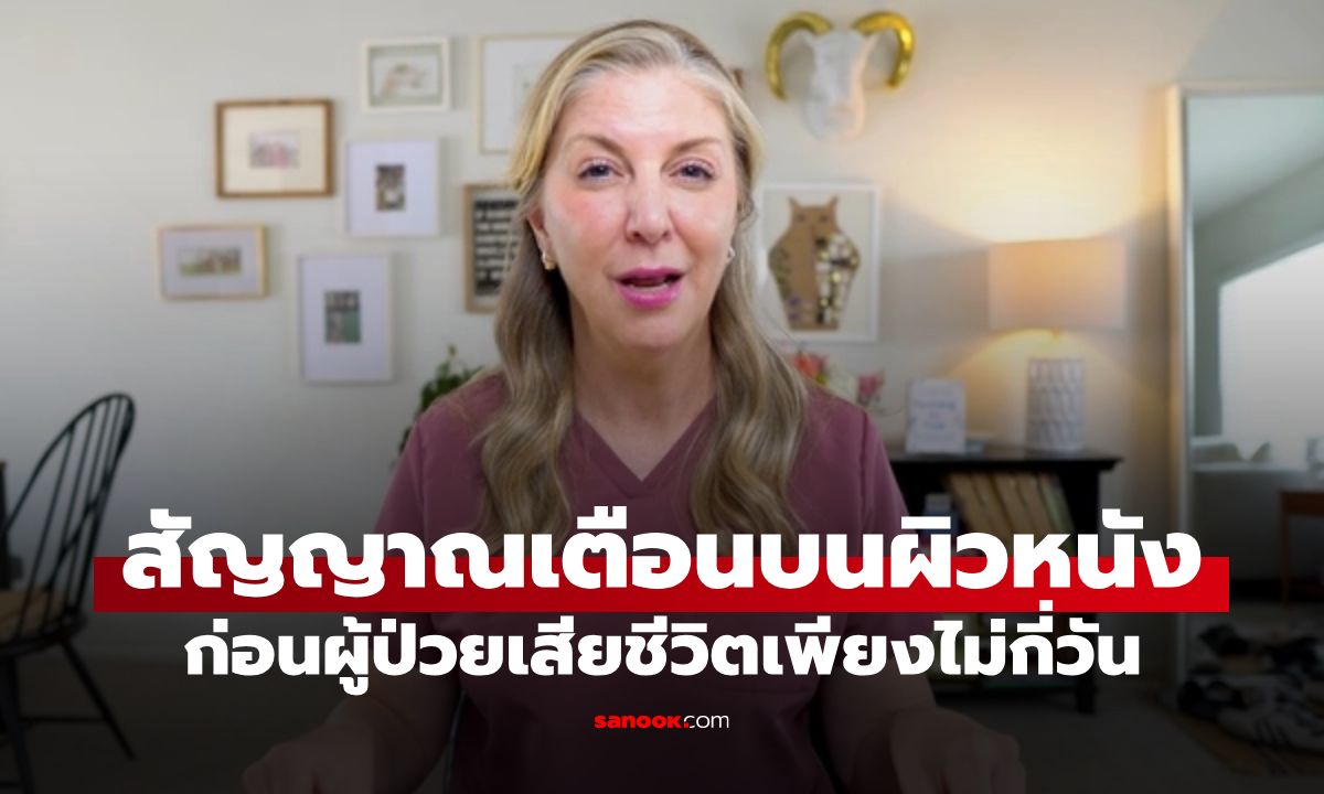 พยาบาลเผย "สัญญาณเตือนบนผิวหนัง" โผล่ขึ้นก่อนผู้ป่วยเสียชีวิตเพียงไม่กี่วัน